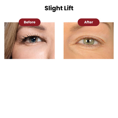 Lidtique Eyelid Lift Kit