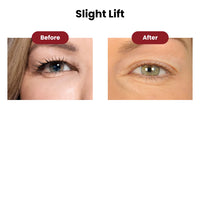 Lidtique Eyelid Lift Kit