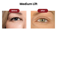 Lidtique Eyelid Lift Kit
