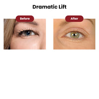 Lidtique Eyelid Lift Kit